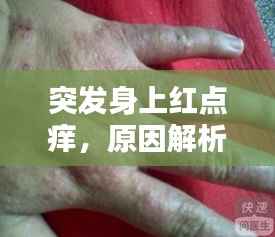 突发身上红点痒,原因解析及应对妙招