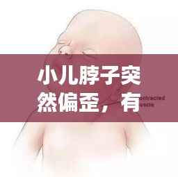 小儿脖子突然偏歪，有效治疗方法大盘点